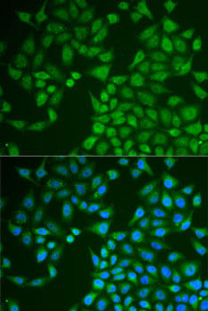 Metabolism Antibodies 2 Anti-PNLIP Antibody CAB6396