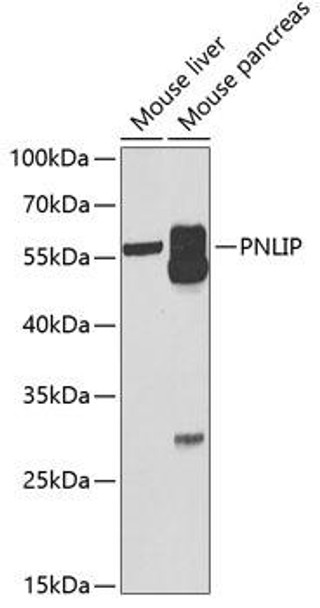 Metabolism Antibodies 2 Anti-PNLIP Antibody CAB6396