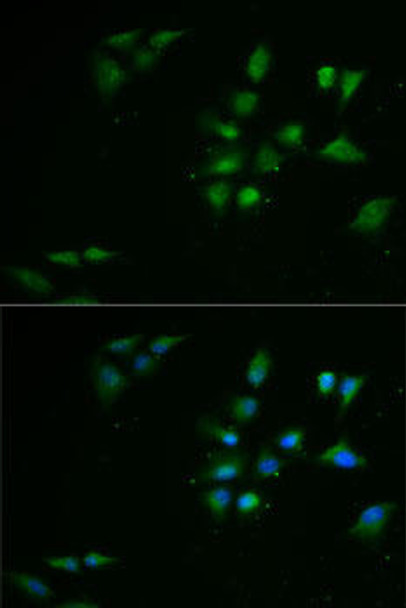 Metabolism Antibodies 2 Anti-PPOX Antibody CAB6397