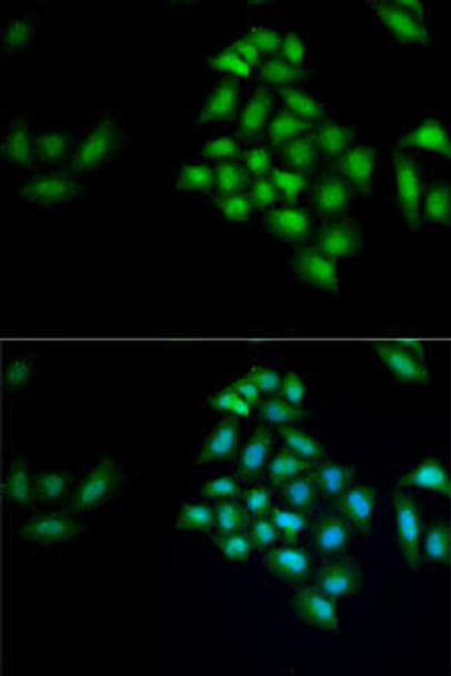 Cell Cycle Antibodies 1 Anti-KLK10 Antibody CAB6398