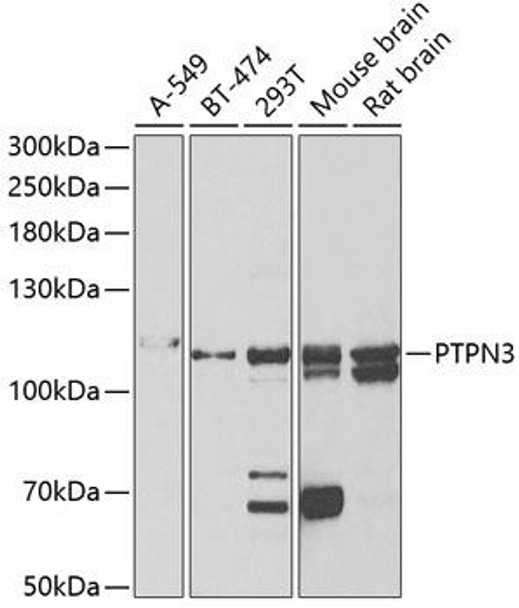 Cell Biology Antibodies 10 Anti-PTPN3 Antibody CAB6400