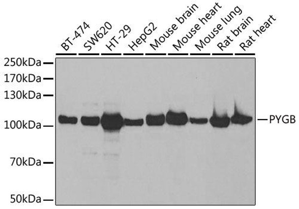 Metabolism Antibodies 2 Anti-PYGB Antibody CAB6402