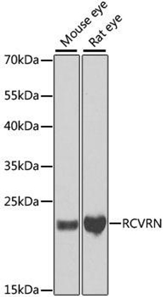 Signal Transduction Antibodies 3 Anti-RCVRN Antibody CAB6404