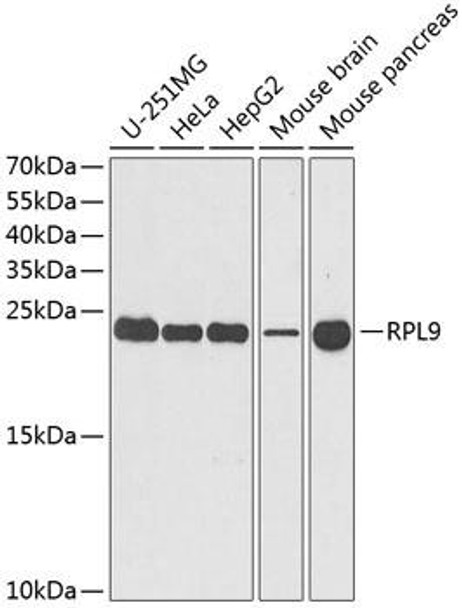 Cell Biology Antibodies 10 Anti-RPL9 Antibody CAB6406