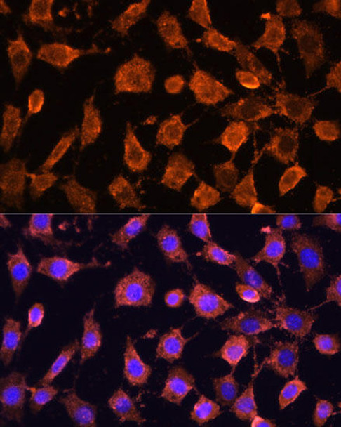 Cell Biology Antibodies 10 Anti-RPL11 Antibody CAB6407