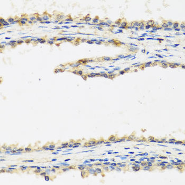 Cell Biology Antibodies 10 Anti-SPINT1 Antibody CAB6411