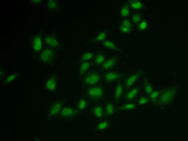 Epigenetics and Nuclear Signaling Antibodies 4 Anti-SSRP1 Antibody CAB6413