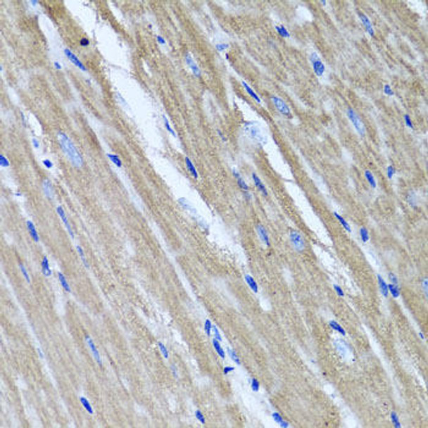 Cell Biology Antibodies 10 Anti-TNFAIP6 Antibody CAB6419