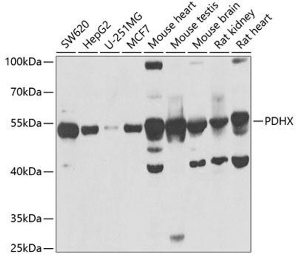 Cell Biology Antibodies 10 Anti-PDHX Antibody CAB6426