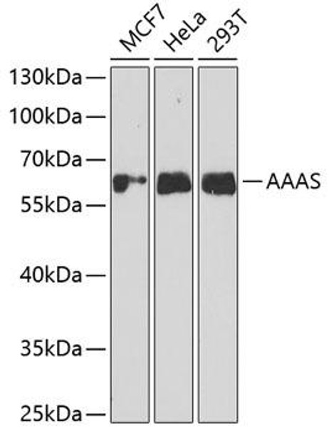 Epigenetics and Nuclear Signaling Antibodies 4 Anti-AAAS Antibody CAB6427