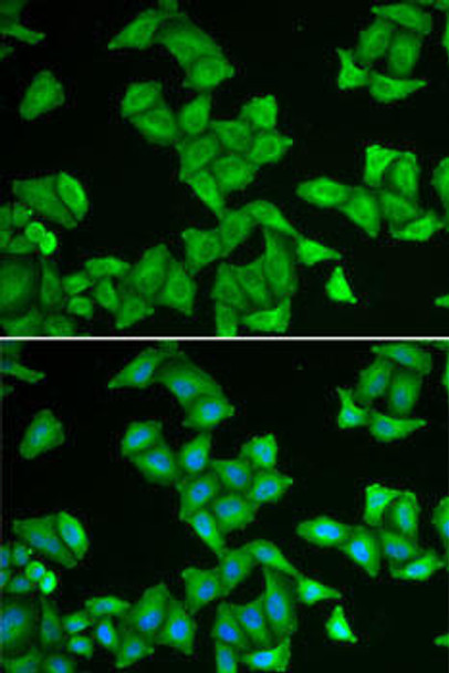 Cell Biology Antibodies 10 Anti-COX5A Antibody CAB6437