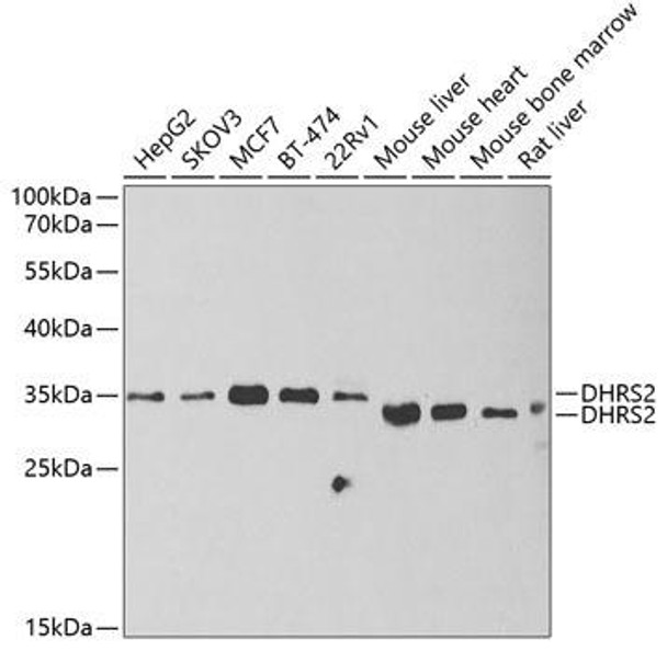 Cell Biology Antibodies 10 Anti-DHRS2 Antibody CAB6446