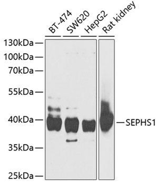 Cell Biology Antibodies 10 Anti-SEPHS1 Antibody CAB6454