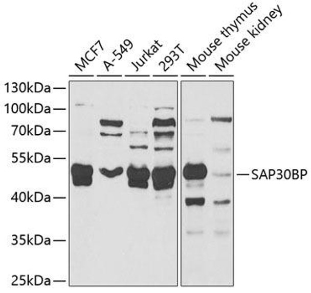 Cell Death Antibodies 2 Anti-SAP30BP Antibody CAB6460