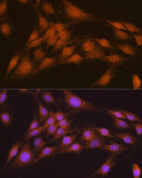 Autophagy Antibodies Anti-NRBF2 Antibody CAB6462