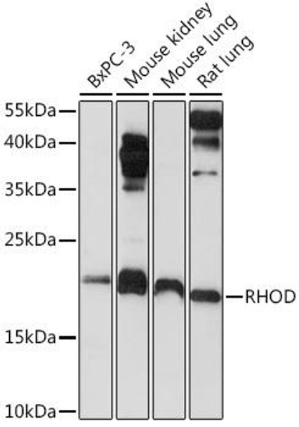 Cell Biology Antibodies 10 Anti-RHOD Antibody CAB6463