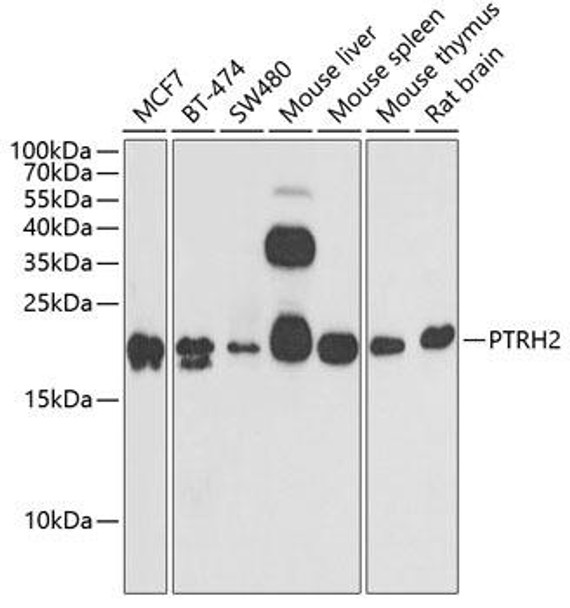 Cell Death Antibodies 2 Anti-PTRH2 Antibody CAB6466
