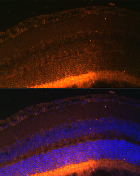 Signal Transduction Antibodies 3 Anti-GRK1 Antibody CAB6497