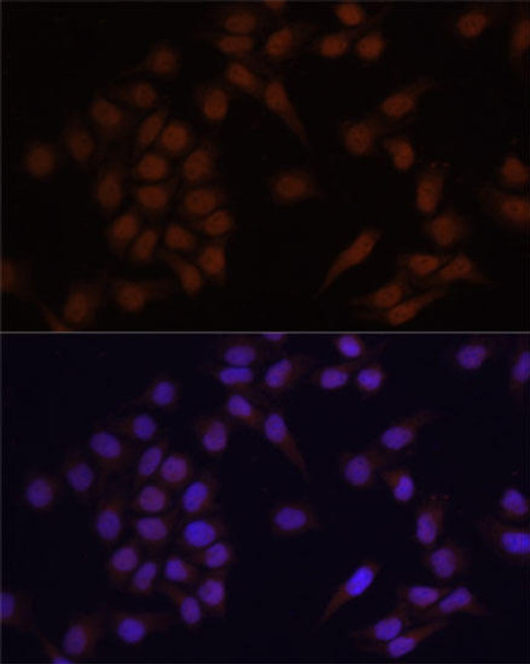 Cell Biology Antibodies 16 Anti-PRDM14 Antibody CAB6502