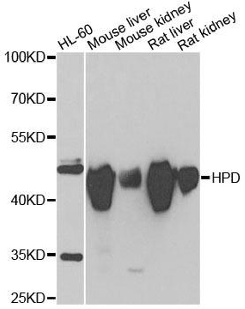 Metabolism Antibodies 2 Anti-HPD Antibody CAB6505