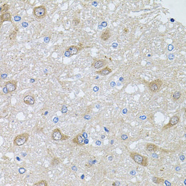 Cell Biology Antibodies 10 Anti-AKAP5 Antibody CAB6520