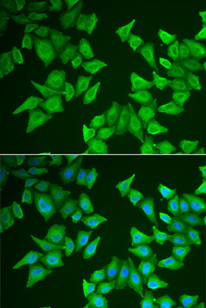 ChIP Antibodies Anti-ALAS2 Antibody CAB6522