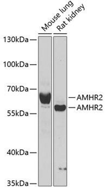 Cell Biology Antibodies 10 Anti-AMHR2 Antibody CAB6523