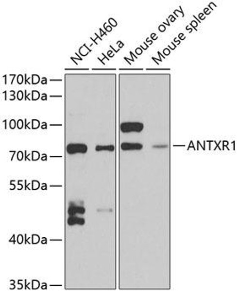 Cell Biology Antibodies 10 Anti-ANTXR1 Antibody CAB6525