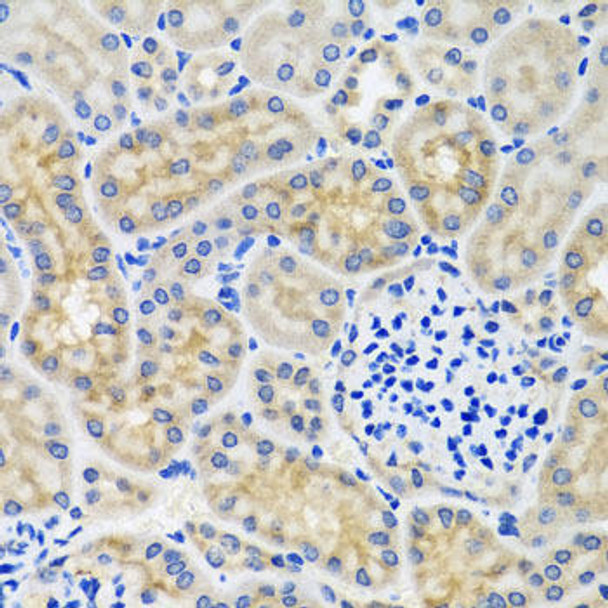 Cell Biology Antibodies 10 Anti-ANTXR2 Antibody CAB6526