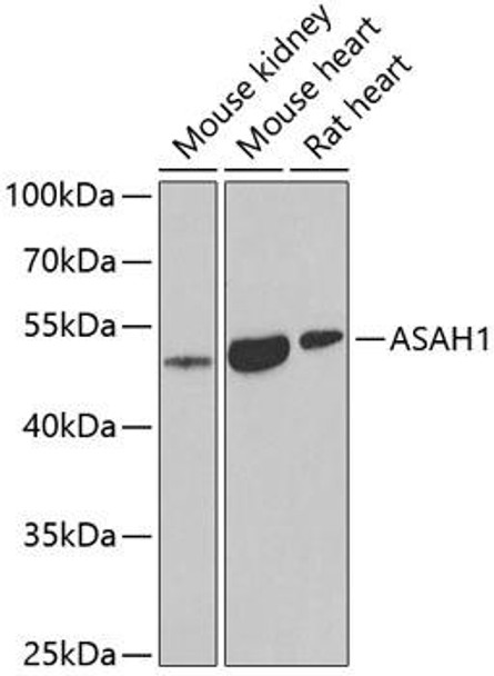 Metabolism Antibodies 2 Anti-ASAH1 Antibody CAB6527