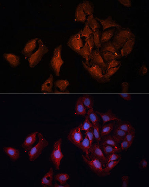 Signal Transduction Antibodies 3 Anti-BAP1 Antibody CAB6533