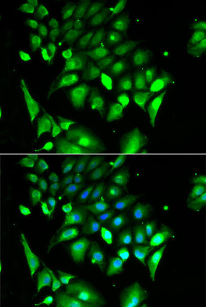 Cell Biology Antibodies 10 Anti-BHLHE40 Antibody CAB6534