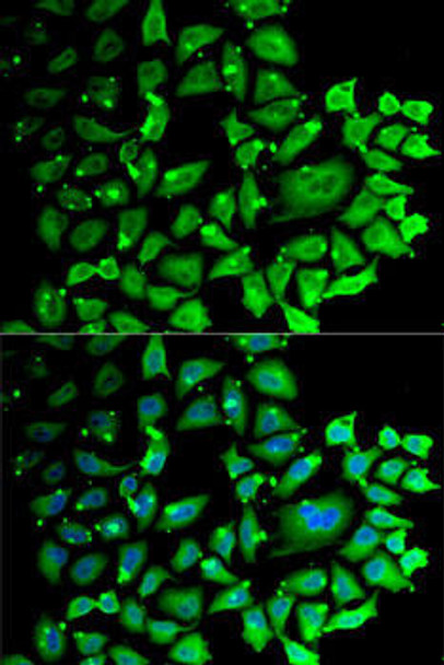 Epigenetics and Nuclear Signaling Antibodies 4 Anti-Cyclin C Antibody CAB6545