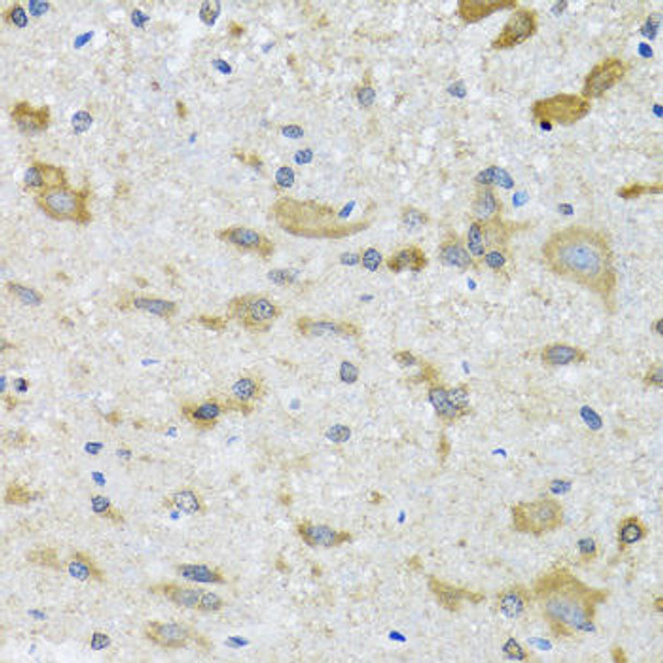 Cell Biology Antibodies 10 Anti-CCT4 Antibody CAB6548