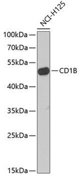 Immunology Antibodies 2 Anti-CD1B Antibody CAB6551