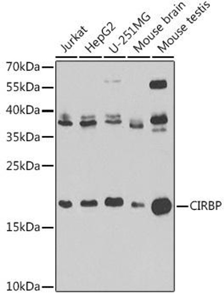 KO Validated Antibodies 1 Anti-CIRBP Antibody CAB6559KO Validated