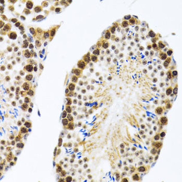 KO Validated Antibodies 1 Anti-CIRBP Antibody CAB6559KO Validated