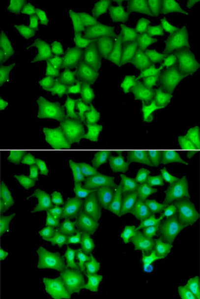 Cell Biology Antibodies 10 Anti-CPSF3L Antibody CAB6566