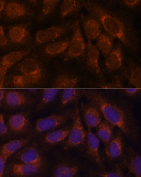 Cell Biology Antibodies 10 Anti-CREB3 Antibody CAB6567