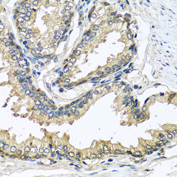 Cell Biology Antibodies 10 Anti-CST1 Antibody CAB6570