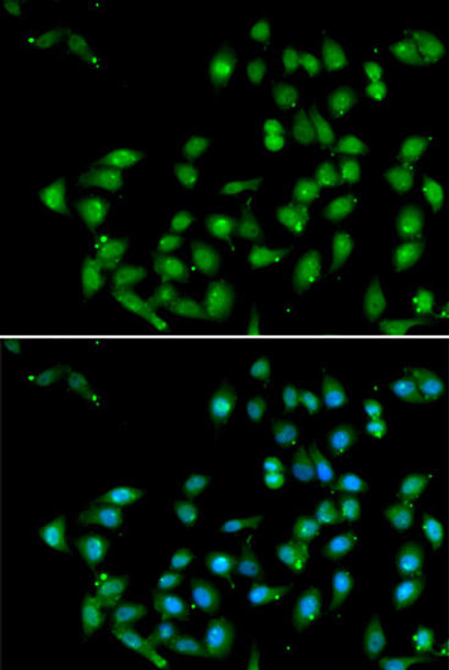 Cell Death Antibodies 2 Anti-CTNNBL1 Antibody CAB6572
