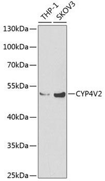 Metabolism Antibodies 2 Anti-CYP4V2 Antibody CAB6573