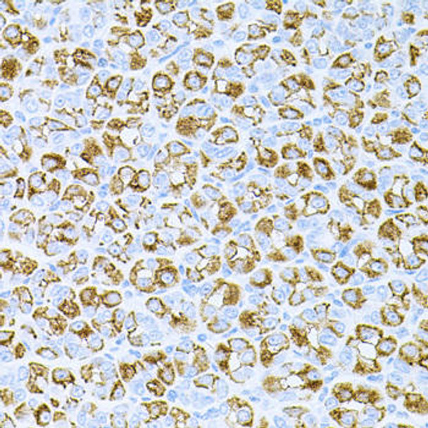 Cell Biology Antibodies 10 Anti-DLK1 Antibody CAB6578