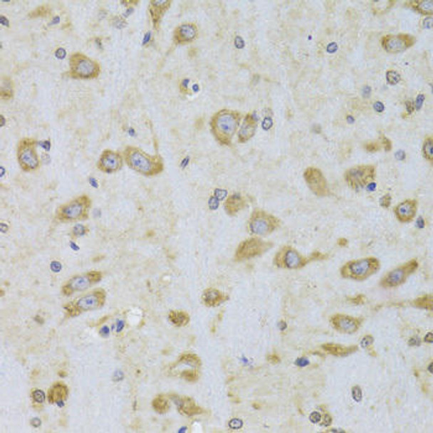 KO Validated Antibodies 1 Anti-EEF1B2 Antibody CAB6580KO Validated