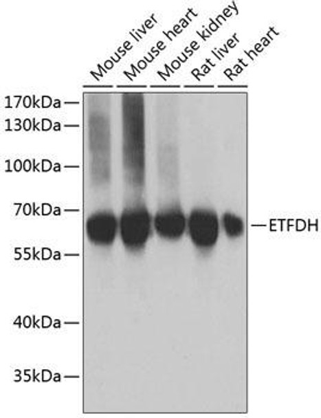 Cell Biology Antibodies 10 Anti-ETFDH Antibody CAB6585