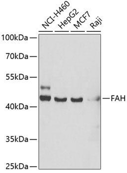 Metabolism Antibodies 2 Anti-FAH Antibody CAB6586