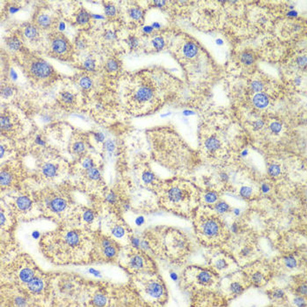 Cell Biology Antibodies 10 Anti-GLUD2 Antibody CAB6604