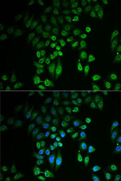 Cell Biology Antibodies 10 Anti-GPLD1 Antibody CAB6612