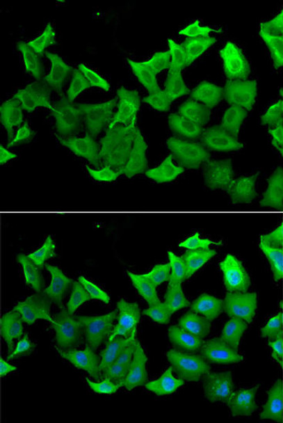 Cell Biology Antibodies 10 Anti-HAGH Antibody CAB6615