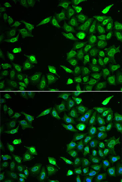 Cell Biology Antibodies 10 Anti-INTS6 Antibody CAB6634